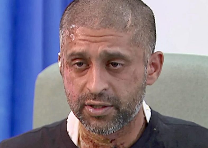 Surge of Acid Attacks in UK – sudden rise in 3 years Surge of Acid Attacks in UK